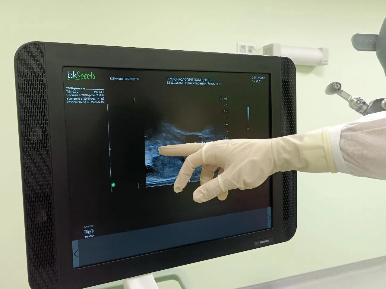 В Онкологическом центре Калининградской области впервые в регионе начато проведение стереотаксической лучевой терапии 