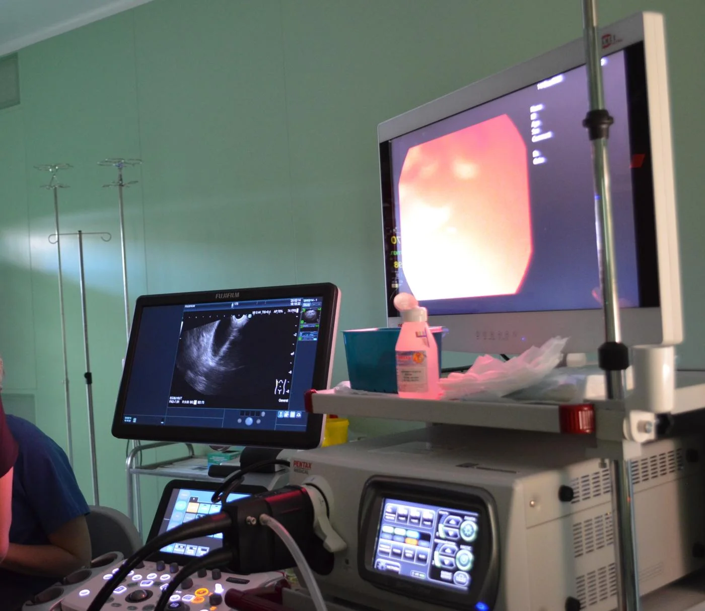 Уникальная диагностика и слаженная работа врачей онкоцентра спасли жизнь пациенту с редкой опухолью