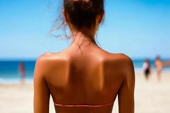 Осторожно - солнечный ожог! Осторожно - солнечный ожог!